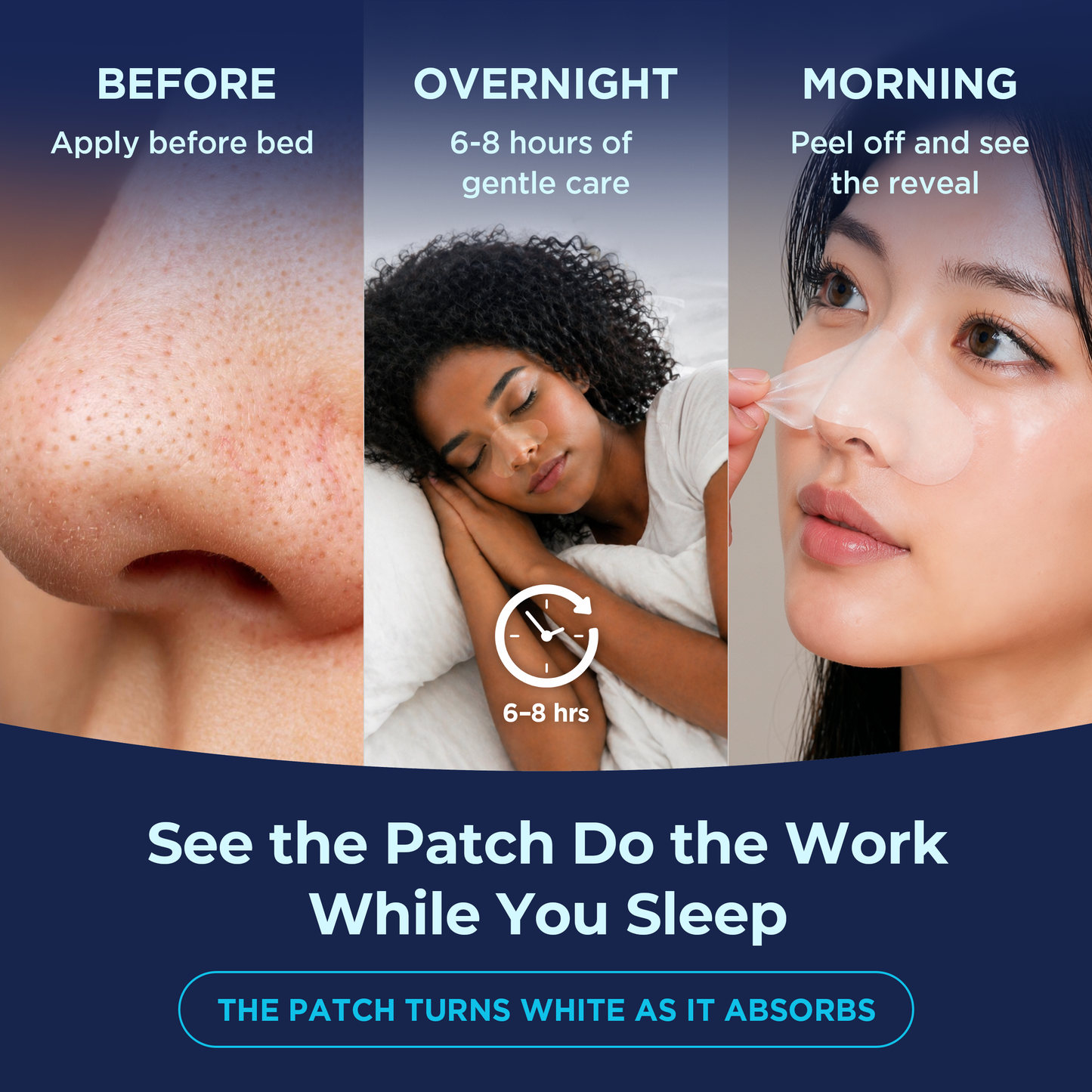 LUNE & BE Overnight Nose Patch (5 Patches)